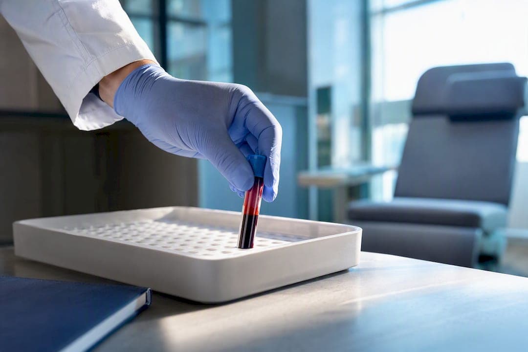2026 U.S. PSA Screening Guidelines: Start, Stop, Repeat (2–4 yrs)